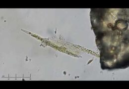 Bacillaria paxillifer Diatoms