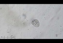 Foraminifera Test Chambers