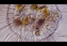 Actinosphaerium Feeding on Vorticella