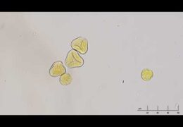Pollen from Honey Samples