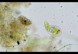 Freshwater Ciliate Eating Algae