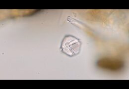 Dinoflagellate – Protoperidinium sp.