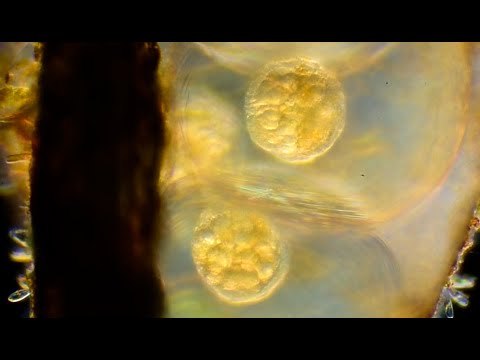 Early Stage Snail Eggs - Thai Microcosmos